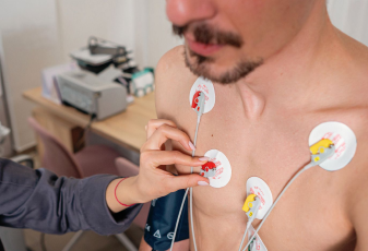 EKG (Electrocardiogram)